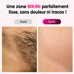 Nyvora™ Skin PRO – Photoépilateur IPL