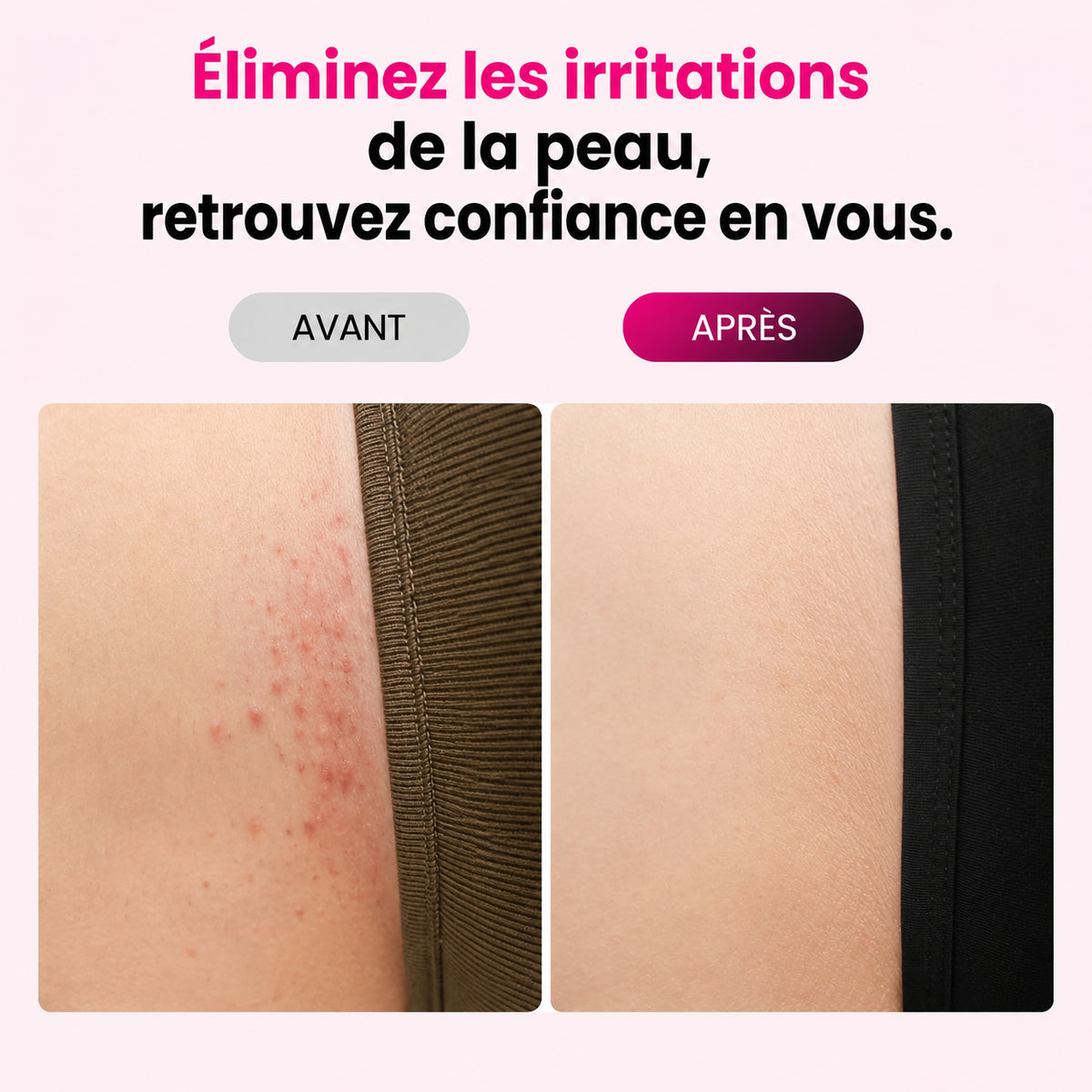 Nyvora™ Skin PRO – Photoépilateur IPL