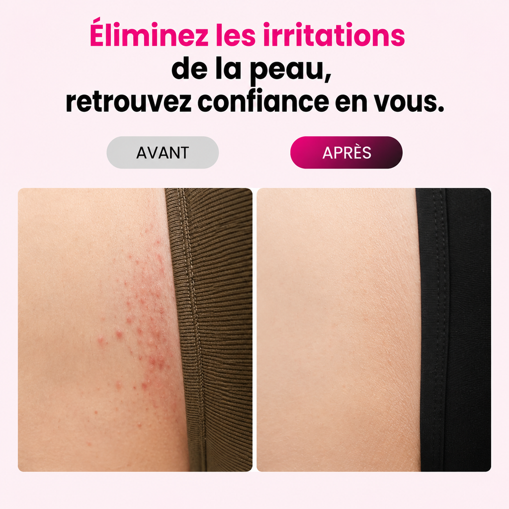 Nyvora™ Skin PRO – Photoépilateur IPL