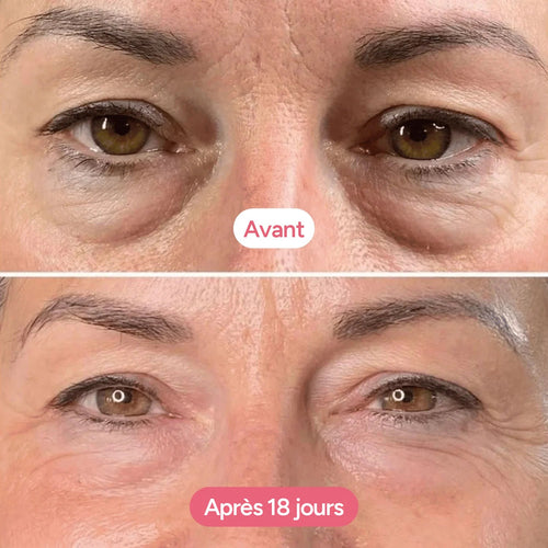 Baume Volumateur Contour des Yeux